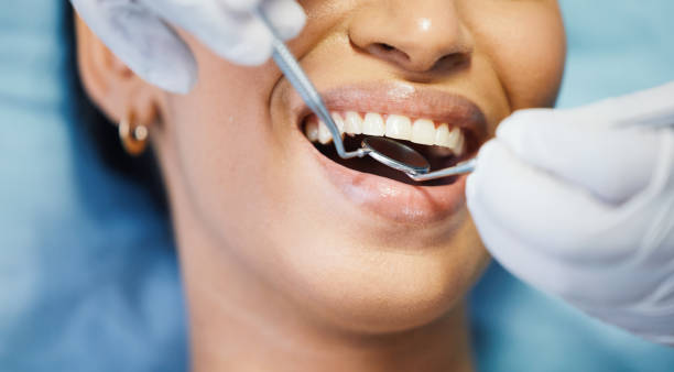 Best Emergency Dental Extractions in Stanley, VA